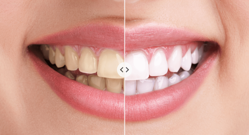 Dentalhygiene & Bleaching Tanja Kudrnovski