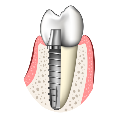 Dr. med. et Dr. med. dent. Nikolaos Chatzis-Logo
